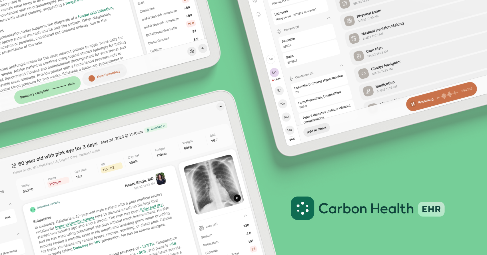 Charting.com Website 